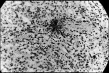 hot-particle-lung-tissue1997