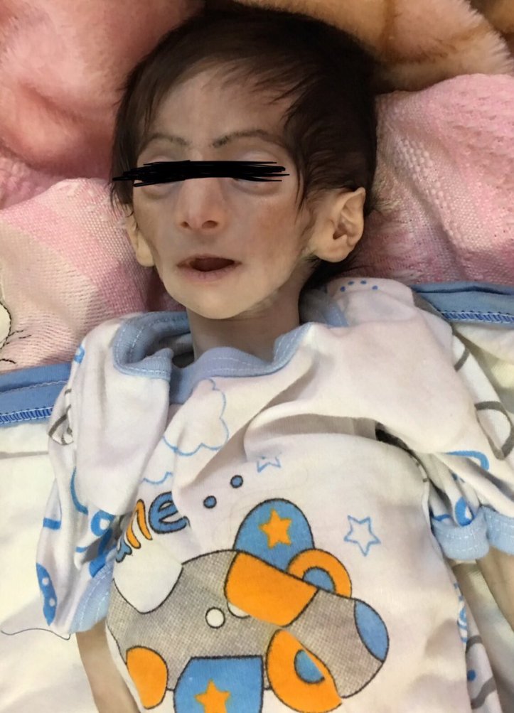 dismorphic - end of April 2018 FJH