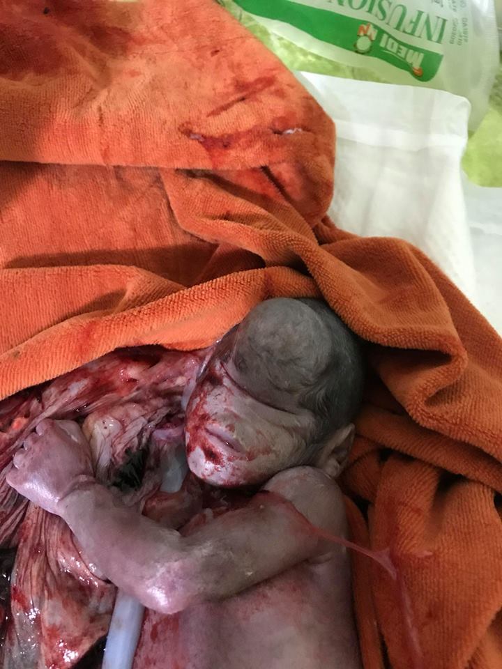 DIsmorphic features FJH 17 april 18