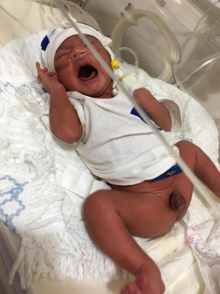 Sexe non identifié FJH avril 2018